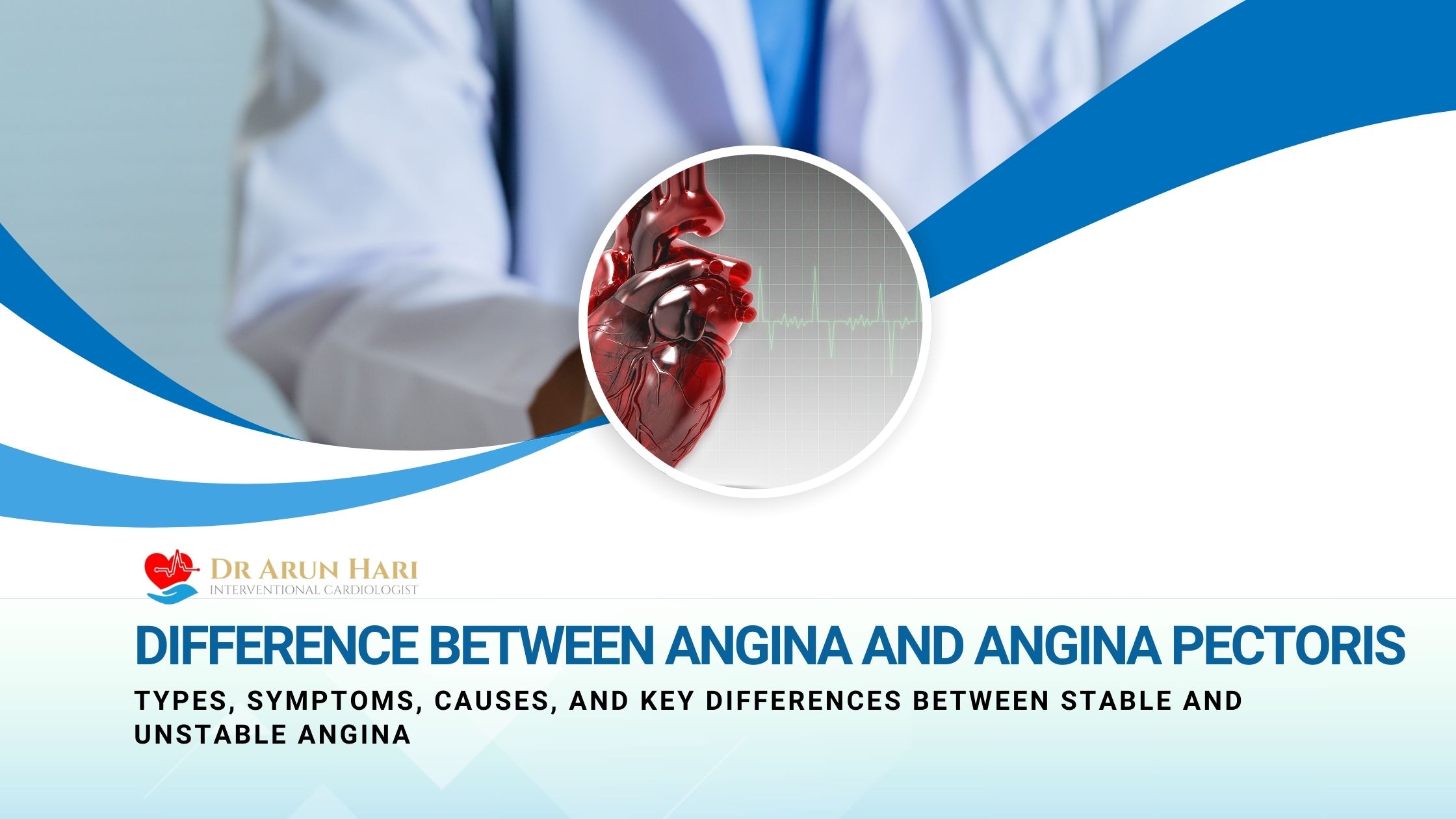 Read more about the article Difference Between Angina and Angina Pectoris – Types, Symptoms, Causes, and Key Differences Between Stable and Unstable Angina