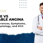 Stable vs Unstable Angina: Key Differences, Symptoms, Pathophysiology, and ECG Findings