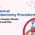 Mechanical Thrombectomy Complications: Risks and Management