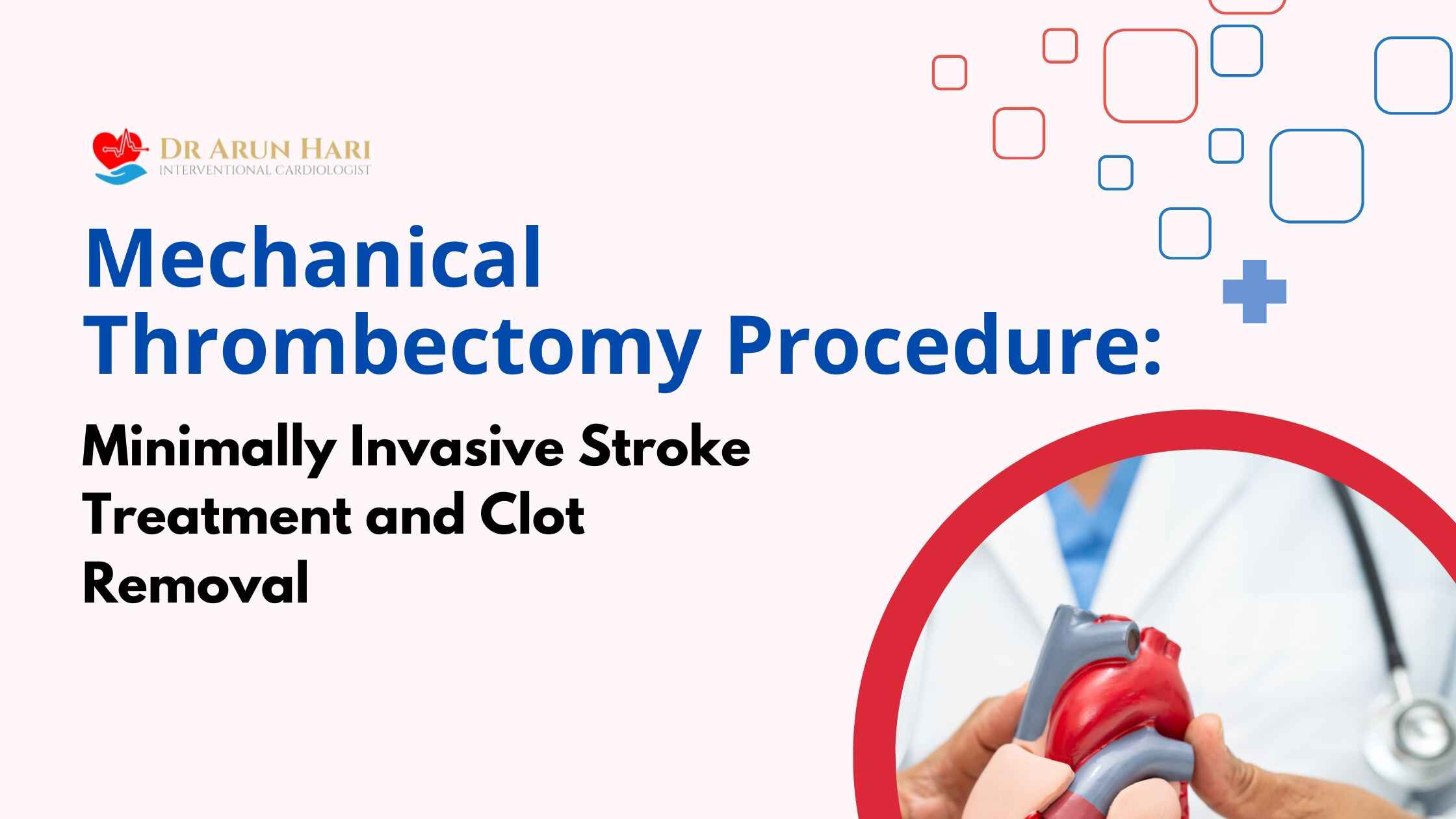 You are currently viewing Mechanical Thrombectomy Complications: Risks and Management