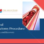 Mechanical Thrombectomy Procedure: Minimally Invasive Stroke Treatment and Clot Removal