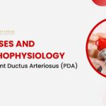 Causes and Pathophysiology of Patent Ductus Arteriosus (PDA)